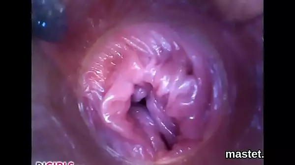 Licky Lex, Silvia Dellai-Raw Endoscopic Video-2017-01-26L 1