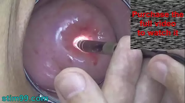 Japanese Gyno Exam Porn