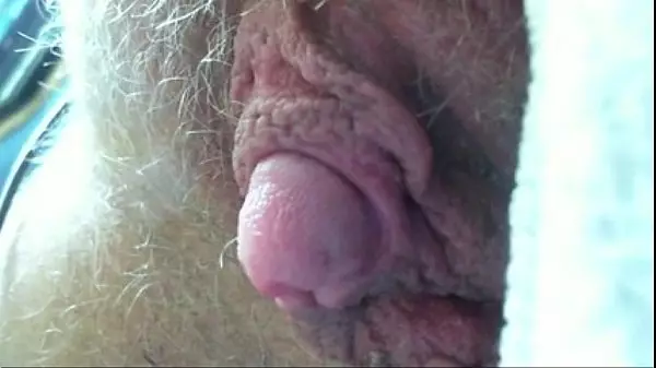Worlds Largest Clit