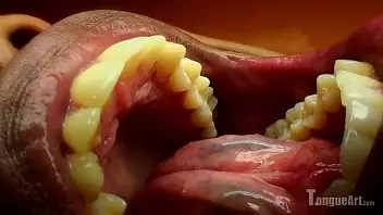 Girl Uvula